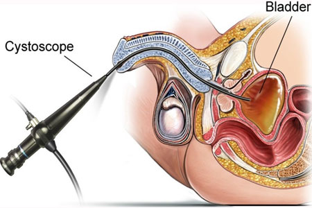 Best Urologist in South Mumbai